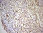 BCL2 Antibody in Immunohistochemistry (Paraffin) (IHC (P))