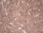 BCL2 Antibody in Immunohistochemistry (Paraffin) (IHC (P))