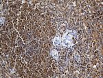 BCL2 Antibody in Immunohistochemistry (Paraffin) (IHC (P))