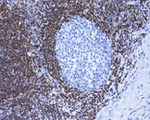 BCL2 Antibody in Immunohistochemistry (Paraffin) (IHC (P))