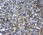 BCL2 Antibody in Immunohistochemistry (Paraffin) (IHC (P))