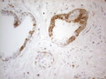 BCL2 Antibody in Immunohistochemistry (Paraffin) (IHC (P))