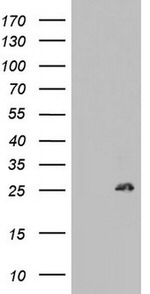 BCL2 Antibody in Western Blot (WB)