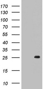 BCL2 Antibody in Western Blot (WB)