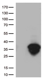 BCL2 Antibody in Western Blot (WB)