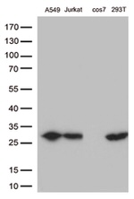 BCL2 Antibody in Western Blot (WB)
