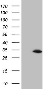 BCL2 Antibody in Western Blot (WB)