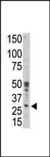 BCL2A1 Antibody in Western Blot (WB)