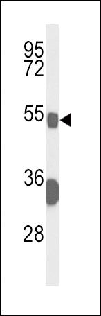 Bcl-3 Antibody in Western Blot (WB)