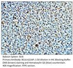 Bcl6 Polyclonal Antibody