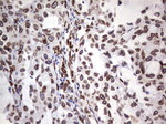 BCL6 Antibody in Immunohistochemistry (Paraffin) (IHC (P))