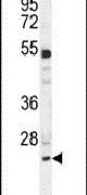 BCL7A Antibody in Western Blot (WB)