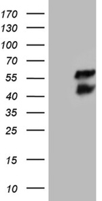 BCL7B Antibody in Western Blot (WB)