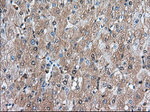 BDH2 Antibody in Immunohistochemistry (Paraffin) (IHC (P))