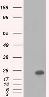 BDH2 Antibody in Western Blot (WB)