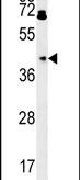 PDHA1 Antibody in Western Blot (WB)