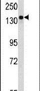 BDP Antibody in Western Blot (WB)