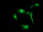 BECN1 Antibody in Immunocytochemistry (ICC/IF)