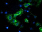 BECN1 Antibody in Immunocytochemistry (ICC/IF)
