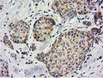 BECN1 Antibody in Immunohistochemistry (Paraffin) (IHC (P))