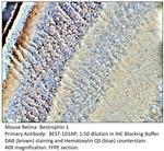 Bestrophin Polyclonal Antibody