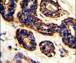Bestrophin 2 Antibody in Immunohistochemistry (IHC)