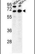 Bestrophin 2 Antibody in Western Blot (WB)