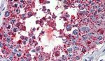 BEST3 Antibody in Immunohistochemistry (Paraffin) (IHC (P))