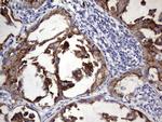 BFSP1 Antibody in Immunohistochemistry (Paraffin) (IHC (P))