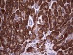 BFSP1 Antibody in Immunohistochemistry (Paraffin) (IHC (P))
