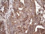 BFSP1 Antibody in Immunohistochemistry (Paraffin) (IHC (P))