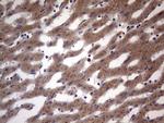 BFSP1 Antibody in Immunohistochemistry (Paraffin) (IHC (P))