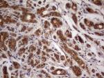 BFSP1 Antibody in Immunohistochemistry (Paraffin) (IHC (P))