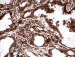 BFSP1 Antibody in Immunohistochemistry (Paraffin) (IHC (P))