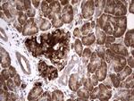 BFSP1 Antibody in Immunohistochemistry (Paraffin) (IHC (P))