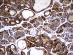BFSP1 Antibody in Immunohistochemistry (Paraffin) (IHC (P))