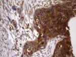 BFSP1 Antibody in Immunohistochemistry (Paraffin) (IHC (P))