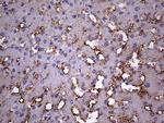 BFSP1 Antibody in Immunohistochemistry (Paraffin) (IHC (P))