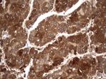 BFSP1 Antibody in Immunohistochemistry (Paraffin) (IHC (P))