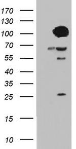 BFSP1 Antibody in Western Blot (WB)