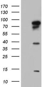 BFSP1 Antibody in Western Blot (WB)