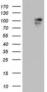 BFSP1 Antibody in Western Blot (WB)