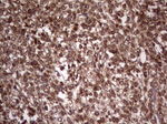 BFSP2 Antibody in Immunohistochemistry (Paraffin) (IHC (P))