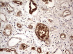 BFSP2 Antibody in Immunohistochemistry (Paraffin) (IHC (P))