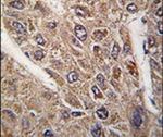 BICD2 Antibody in Immunohistochemistry (IHC)