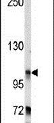 BICD2 Antibody in Western Blot (WB)