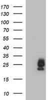 BID Antibody in Western Blot (WB)