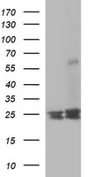 BID Antibody in Western Blot (WB)