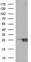 BID Antibody in Western Blot (WB)