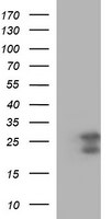 BID Antibody in Western Blot (WB)